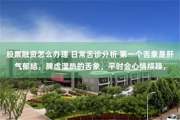 股票融资怎么办理 日常舌诊分析 第一个舌象是肝气郁结，脾虚湿热的舌象，平时会心情烦躁，